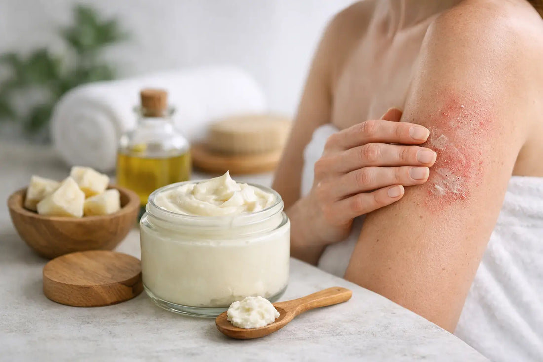 Is Tallow Body Butter for Eczema Worth It?